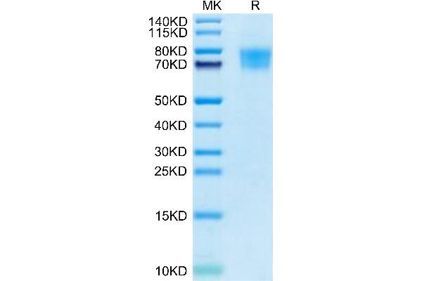 TIMD4 Protein (AA 25-305) (His tag)