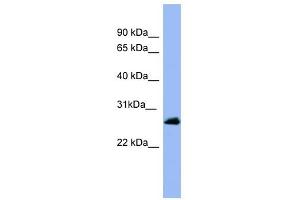 RAB5A antibody used at 1 ug/ml to detect target protein. (RAB5 anticorps  (Middle Region))