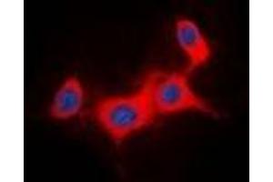 Immunofluorescent analysis of IRS1 staining in HeLa cells. (IRS1 anticorps)