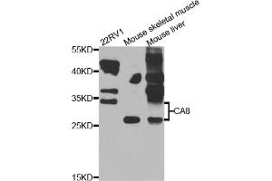 Western blot analysis of extracts of various cell lines, using CA8 antibody (ABIN5975602) at 1/1000 dilution. (CA8 anticorps)