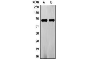 Western blot analysis of Frizzled 5 expression in PC3 (A), LOVO (B) whole cell lysates. (FZD5 anticorps  (C-Term))