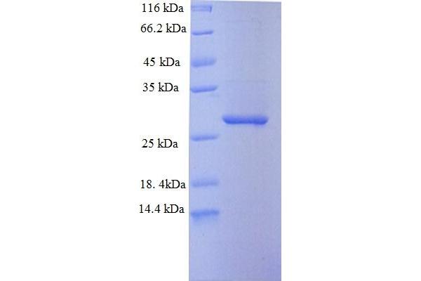 SAMHD1 Protein (AA 395-626) (His tag)