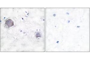 Immunohistochemistry analysis of paraffin-embedded human brain tissue, using Notch 1 (Cleaved-Val1754) Antibody. (Notch1 anticorps  (Cleaved-Val1754))