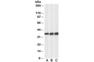 Western blot testing of human [A], mouse [B] and rat [C] heart lysates with Lactate Dehydrogenase B antibody at 0. (LDHB anticorps)