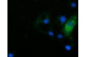 Anti-HDAC6 mouse monoclonal antibody (ABIN2453117) immunofluorescent staining of COS7 cells transiently transfected by pCMV6-ENTRY HDAC6 (RC209649). (HDAC6 anticorps)