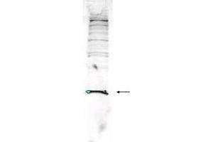 Western blot analysis is shown using  Affinity Purified anti-Human PARK7 antibody to detect PARK7 present in Jurkat whole cell lysate. (PARK7/DJ1 anticorps  (AA 177-189))