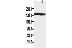 Anti-Collagen II antibody,  Western blotting Lane 1: Rat Heart Tissue Lysate Lane 1: Rat Brain Tissue Lysate (COL2A1 anticorps  (C-Term))