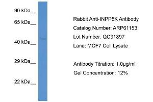 Western Blotting (WB) image for anti-Inositol Polyphosphate-5-Phosphatase K (INPP5K) (N-Term) antibody (ABIN970963) (INPP5K anticorps  (N-Term))