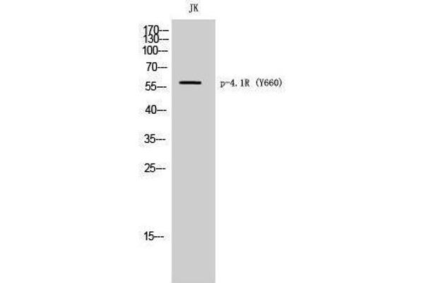 EPB41 anticorps  (pTyr660)