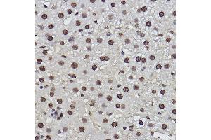 Immunohistochemistry of paraffin-embedded rat liver using PDCD7 Rabbit mAb (ABIN3022039, ABIN3022040, ABIN3022041, ABIN1513274 and ABIN1514421) at dilution of 1:100 (40x lens). (PDCD7 anticorps)