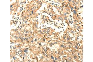 Immunohistochemistry (IHC) image for anti-Agrin (AGRN) antibody (ABIN2431949) (AGRN anticorps)