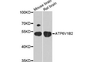 Western Blotting (WB) image for anti-ATPase, H+ Transporting, Lysosomal 56/58kDa, V1 Subunit B2 (ATP6V1B2) (AA 262-511) antibody (ABIN6220345) (ATP6V1B2 anticorps  (AA 262-511))