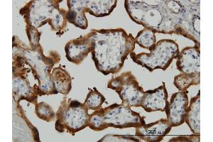 Immunoperoxidase of monoclonal antibody to TGM2 on formalin-fixed paraffin-embedded human placenta. (Transglutaminase 2 anticorps  (AA 1-120))