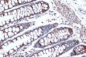 Immunohistochemistry of paraffin-embedded human colon using HSPE1/HSP10/HSPE1/HSP10/CPN10 Rabbit mAb (ABIN7267567) at dilution of 1:100 (40x lens). (HSPE1 anticorps)