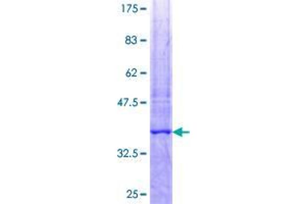 TUBD1 Protein (AA 354-453) (GST tag)