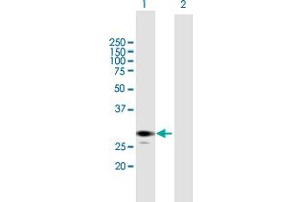 ECHS1 anticorps  (AA 1-290)