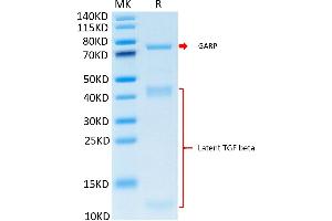 Cynomolgus GARP&Latent TGF beta Complex on Tris-Bis PAGE under reduced condition. (GARP & Latent TGF beta 1 Complex (AA 18-628) protein (His-Avi Tag))