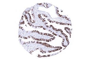 fallopian tube mucosa (Recombinant Cytokeratin 7 anticorps  (AA 1-100))