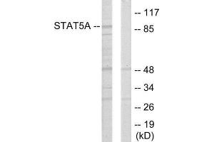 Western Blotting (WB) image for anti-Signal Transducer and Activator of Transcription 5A (STAT5A) (Internal Region) antibody (ABIN1849361) (STAT5A anticorps  (Internal Region))