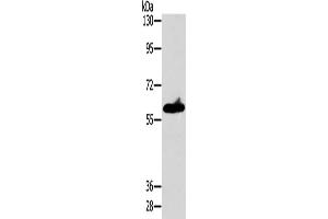 Gel: 8 % SDS-PAGE, Lysate: 40 μg, Lane: A549 cells, Primary antibody: ABIN7128549(ASB3 Antibody) at dilution 1/200, Secondary antibody: Goat anti rabbit IgG at 1/8000 dilution, Exposure time: 10 seconds (ASB3 anticorps)