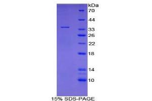 SDS-PAGE analysis of Human Topoisomerase I Protein. (Topoisomerase I Protéine)