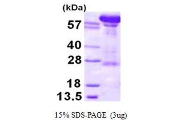 KPNB1 Protein (AA 1-876) (His tag)