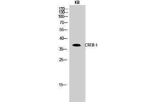 Western Blotting (WB) image for anti-cAMP Responsive Element Binding Protein 1 (CREB1) (Ser256) antibody (ABIN3174548) (CREB1 anticorps  (Ser256))