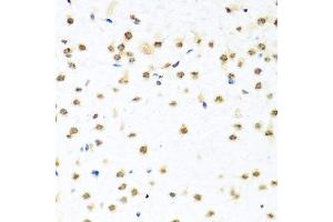 Immunohistochemistry of paraffin-embedded mouse brain using RAB3IP antibody. (RAB3IP anticorps  (AA 1-150))