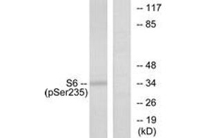 Western blot analysis of extracts from 293 cells treated with serum 10% 15', using S6 Ribosomal Protein (Phospho-Ser235) Antibody. (RPS6 anticorps  (pSer235))