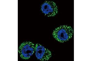 Immunofluorescence (IF) image for anti-Chemokine (C-C Motif) Receptor 7 (CCR7) (AA 11-37), (N-Term) antibody (ABIN651190)