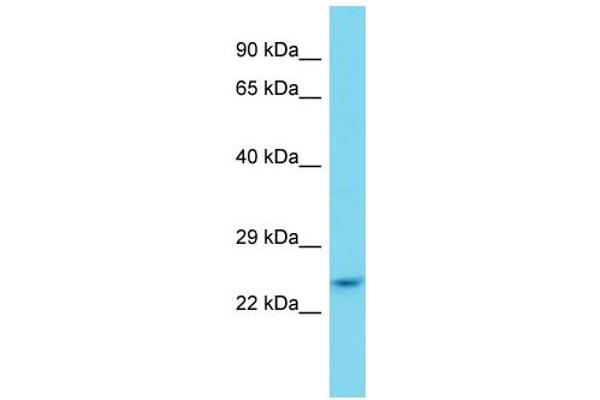 ZFAND2B anticorps  (N-Term)