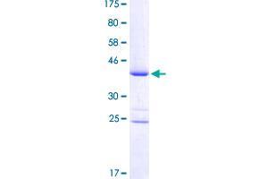 Image no. 1 for Iroquois Homeobox 6 (IRX6) (AA 337-446) protein (GST tag) (ABIN1308123) (IRX6 Protein (AA 337-446) (GST tag))