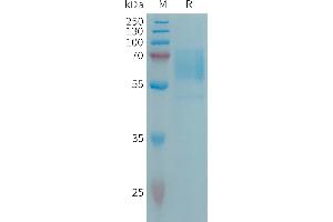 Human CD98 Protein, His Tag on SDS-PAGE under reducing condition. (SLC3A2 Protein (AA 206-630) (His tag))