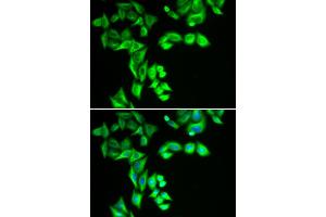 Immunofluorescence analysis of HeLa cells using STRN3 antibody. (STRN3 anticorps)