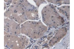 IHC-P analysis of Human Stomach Tissue, with DAB staining. (CXCL14 anticorps  (AA 35-111))