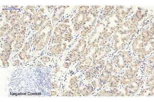 Immunohistochemical analysis of paraffin-embedded human stomach tissue. (Smad2/3 anticorps)