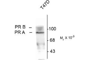 Western blots of whole cell T47D lysate prepared from cells that had been inubated in the presence of the synthetic progestin agonist R5020 (500 nM) showing specific immunolabeling of the ~90k PR-A isoform and the ~120 PR-B isoform of the progesterone receptor phosphorylated at Ser190. (Progesterone Receptor anticorps  (pSer190))