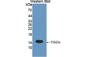 Western blot analysis of the recombinant protein. (TNFRSF19 anticorps  (AA 61-163))