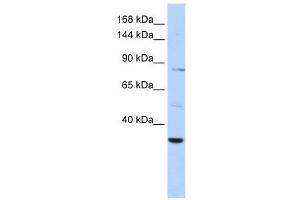 AHNAK2 antibody used at 1 ug/ml to detect target protein. (AHNAK2 anticorps  (Middle Region))