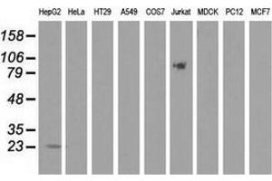 Western blot analysis of extracts (35 µg) from 9 different cell lines by using anti-PEBP1 monoclonal antibody. (PEBP1 anticorps)