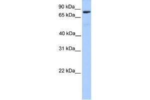 WB Suggested Anti-C12orf40 Antibody Titration: 0. (C12orf40 anticorps  (N-Term))