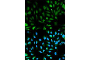 Immunofluorescence analysis of HeLa cells using PARK7 antibody. (PARK7/DJ1 anticorps)