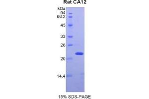 SDS-PAGE analysis of Rat CA12 Protein. (CA12 Protéine)