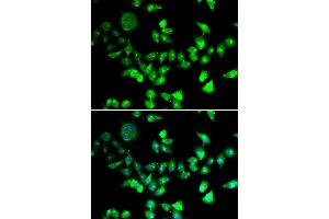 Immunofluorescence analysis of U20S cell using SMC1A antibody. (SMC1A anticorps)