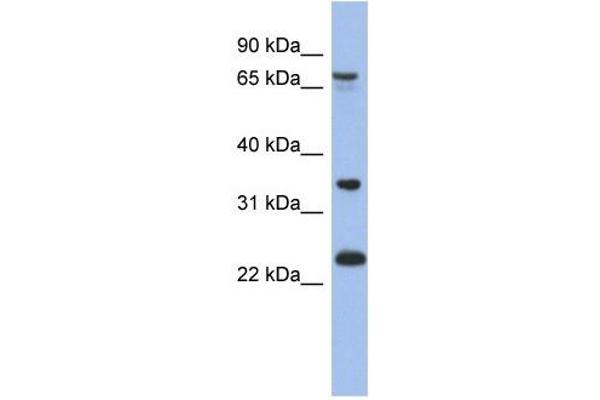 TBC1D25 anticorps  (N-Term)