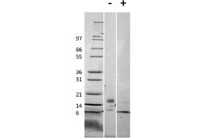 SDS-PAGE of Mouse RELM beta Recombinant Protein SDS-PAGE of Mouse RELM beta Recombinant Protein. (RETNLB Protéine)