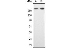 Western blot analysis of MAP2 expression in SKNSH (A), mouse brain (B) whole cell lysates. (MAP2 anticorps  (N-Term))