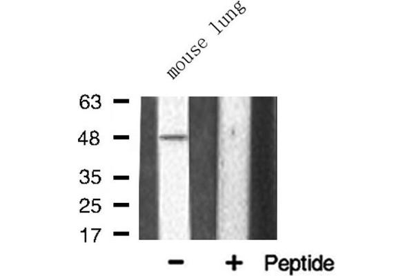 TNFRSF1B anticorps  (C-Term)