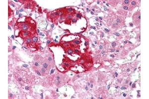 Immunohistochemical analysis of paraffin-embedded human Adrenal tissues using EPHB3 antibody (EPH Receptor B3 anticorps  (AA 39-212))