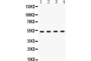 Western blot analysis of BDKRB2 expression in HELA whole cell lysates ( Lane 1), HEPG2 whole cell lysates ( Lane 2), MCF-7 whole cell lysates ( Lane 3) and A549 whole cell lysates ( Lane 4). (BDKRB2 anticorps  (C-Term))